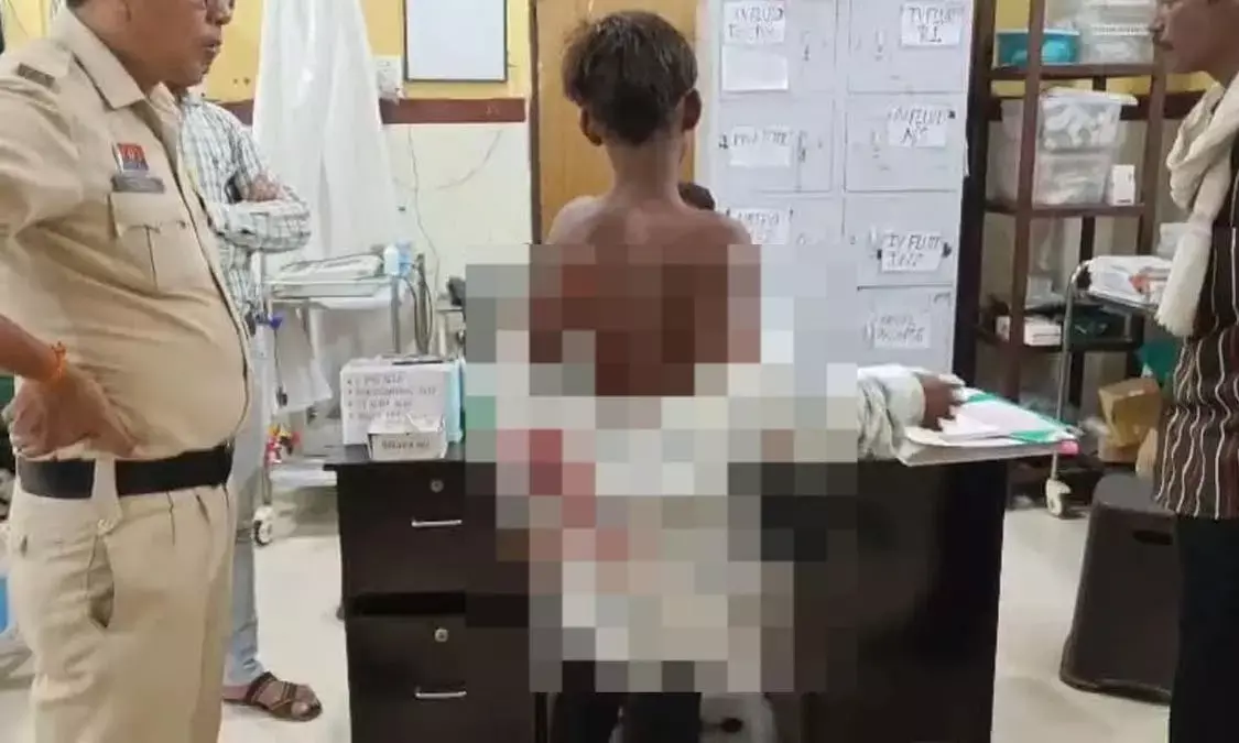 नशा मुक्ति केंद्र के सामने नशेड़ियों का जमघट, मिलावटी शराब के खिलाफ बोलना पड़ा महंगा