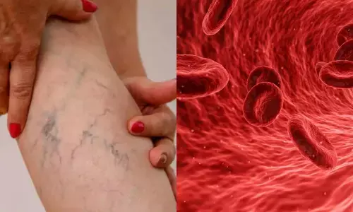 अगर खून लाल है, तो नसें नीली क्यों दिखती हैं? जानिए इसके पीछे का साइंस