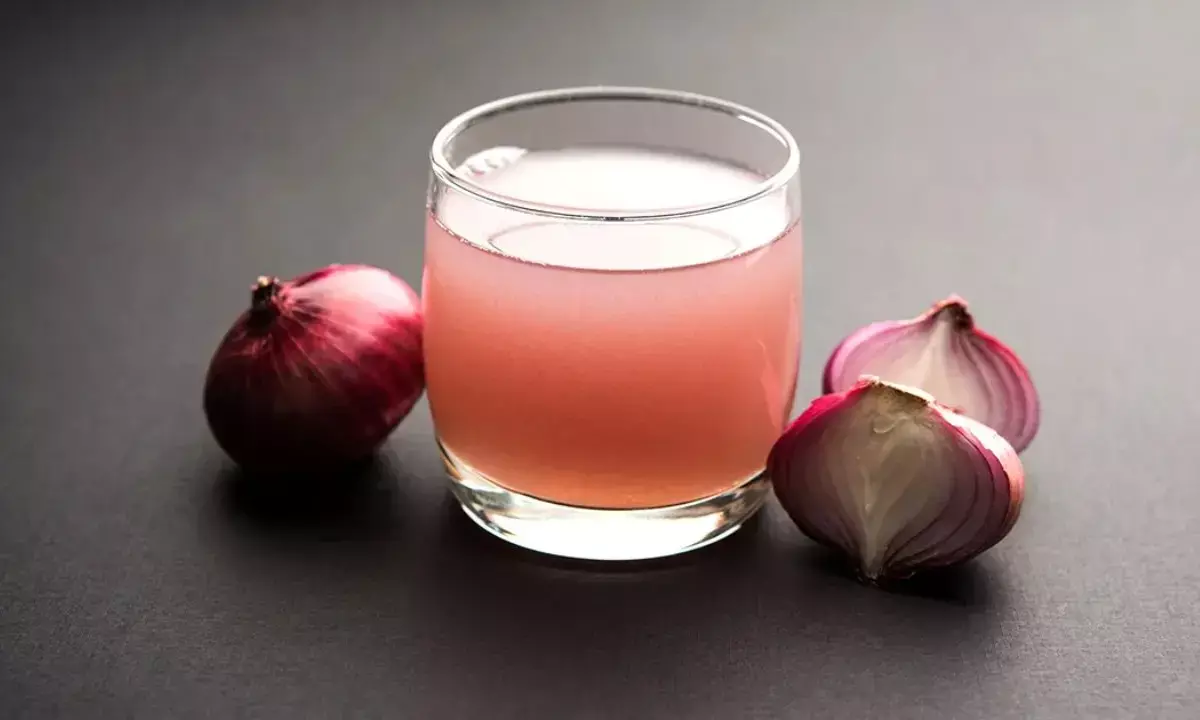 बालों के झड़ने से हो गए हैं परेशान? प्याज का रस दिलाएगा छुटकारा, जानें कैसे करें इस्तेमाल