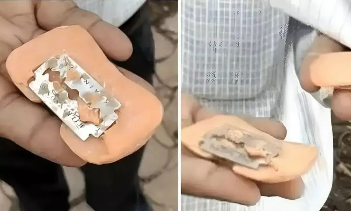 बच्चे के शरीर में आई चोट, शख्स ने की कंज्यूमर फोरम में शिकायत, साबुन कंपनी जांच में जुटी