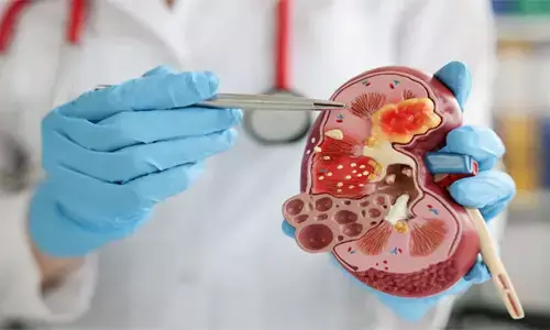 जागरूकता की कमी : पिछले चार महीने से नहीं हुआ अंगदान, किडनी-लिवर के जरूरतमंदों की वेटिंग पहुंची 191 तक