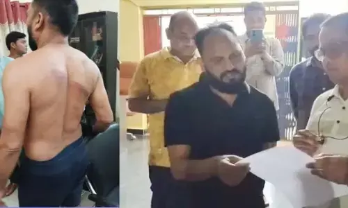 Police beat up Panchayat employees
