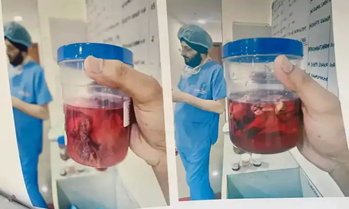 ऑपरेशन के समय गर्भ में छोड़ी पट्टी, यमुनानगर में ढाई माह बाद पेट में दर्द उठने पर खुलासा ऑपरेशन के समय गर्भ में छोड़ी पट्टी, यमुनानगर में ढाई माह बाद पेट में दर्द उठने पर खुलासा