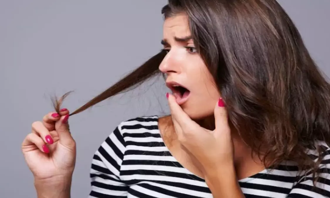 Home Remedies: हेयर फॉल होने पर इन चीजों का करें इस्तेमाल, जल्द रोक देंगे बाल टूटना Home Remedies: हेयर फॉल होने पर इन चीजों का करें इस्तेमाल, जल्द रोक देंगे बाल टूटना