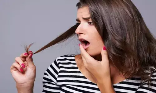 Home Remedies: हेयर फॉल होने पर इन चीजों का करें इस्तेमाल, जल्द रोक देंगे बाल टूटना