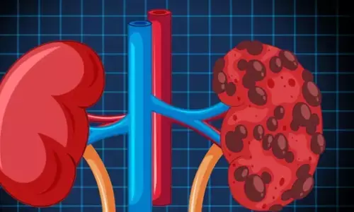 Health Tips: किडनी को रखना है स्वास्थ्य, इन 3 आदतों को आज से ही छोड़ दें