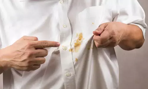 white cloth stain cleaning tips