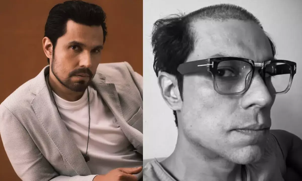 randeep hooda shaves half head new look photo viral