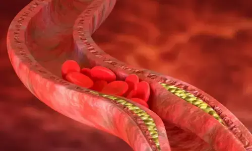 Home Remedies for Cholesterol: बढ़ते कॉलेस्ट्रॉल को कैसे करें कम, इन घरेलू उपायों से पाएं राहत Home Remedies for Cholesterol: बढ़ते कॉलेस्ट्रॉल को कैसे करें कम, इन घरेलू उपायों से पाएं राहत