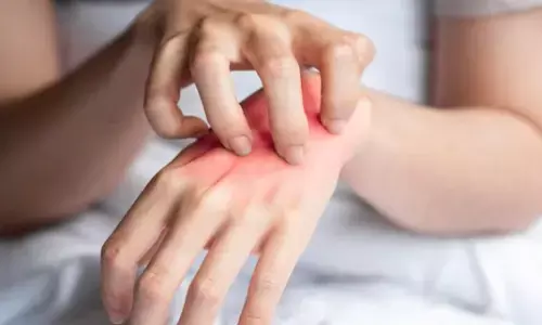 Home Remedies: मॉनसून में स्किन इरिटेशन से मिलेगी राहत, बस नहाने के पानी में मिलाएं ये 5 चीजें