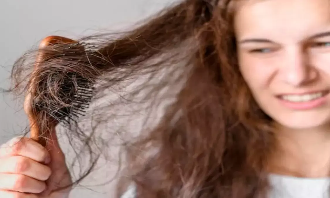 बारिश के मौसम में बालों का टूटना होगा बंद, फॉलो करें ये 5 टिप्स