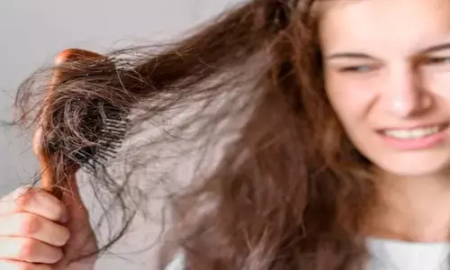 बारिश के मौसम में बालों का टूटना होगा बंद, फॉलो करें ये 5 टिप्स