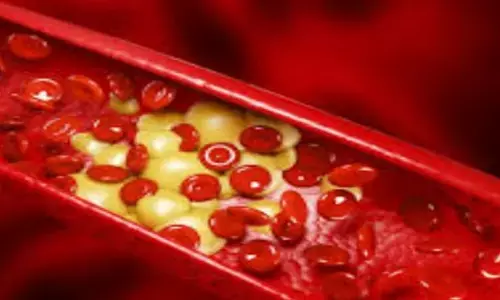 Home Remedies: कोलेस्ट्रॉल कम करने का रामबाण इलाज, हमेशा रहेंगे सवस्थ