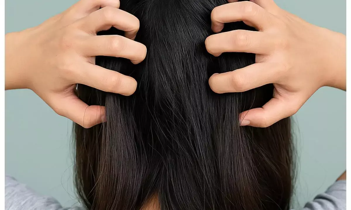 itchy hair care tips itchy hair care tips