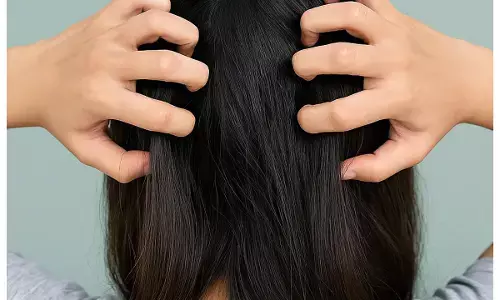 itchy hair care tips itchy hair care tips