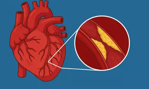 cholesterol home remedies cholesterol home remedies