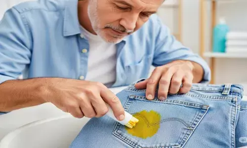 turmeric stains on clothes