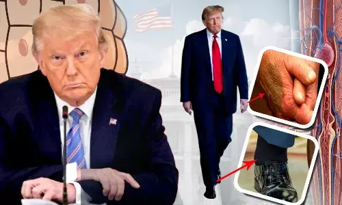 Donald Trump Disease