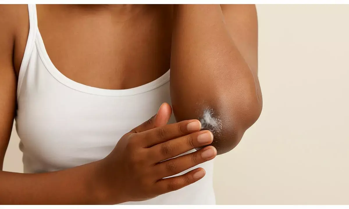 चंद मिनटों में कोहनी का कालापन होगा दूर, अपना लें ये 5 घरेलू नुस्खे