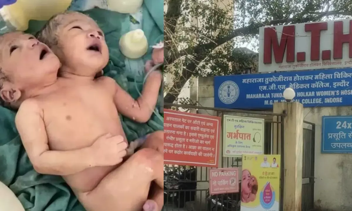 Parapagus Dicephalic Twins