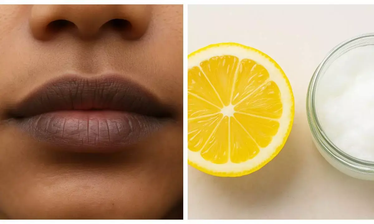 home remedies for black lips