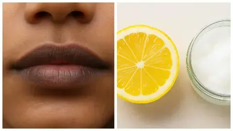 home remedies for black lips