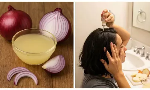 hair care with onion juice pyaj ka ras