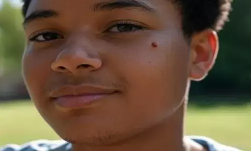 लाल तिल की समस्या