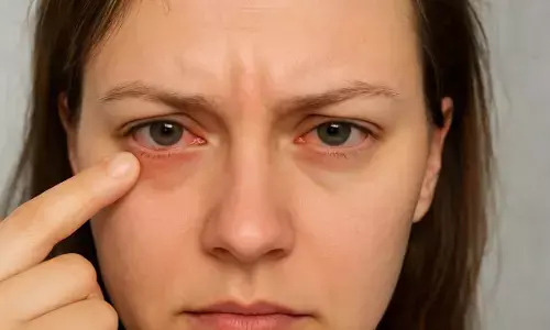 आंखों में होने वाली परेशानी की वजह क्या है