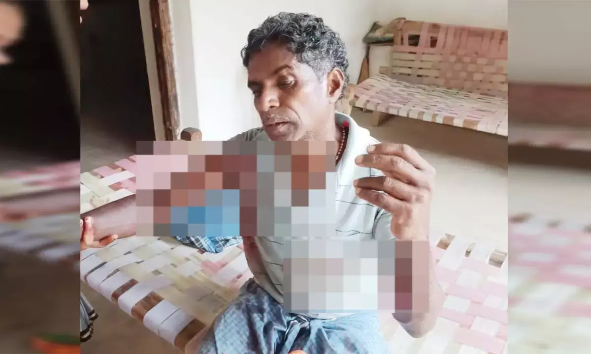 घायल ग्रामीण