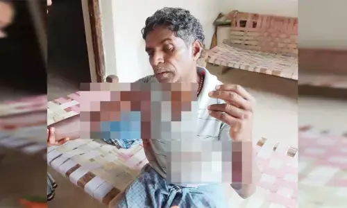 घायल ग्रामीण