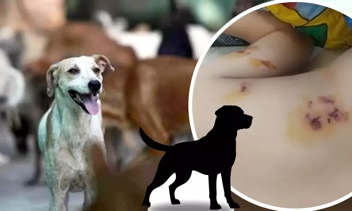 Stray Dogs A​attack East Delhi