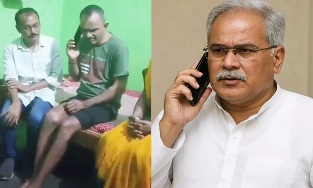 पूर्व सीएम भूपेश बघेल ने बीजेपी नेता विशंभर यादव को इलाज के लिए रायपुर बुलाया है