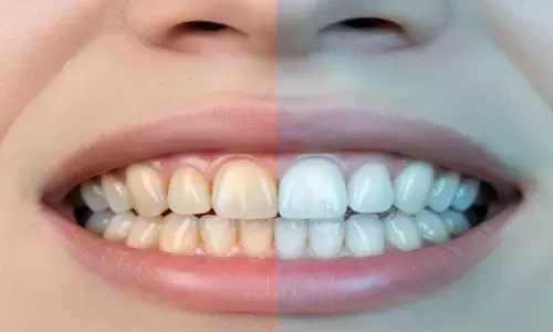teeth yellowness home remedies daaton ka peelapan door karne ke tarike