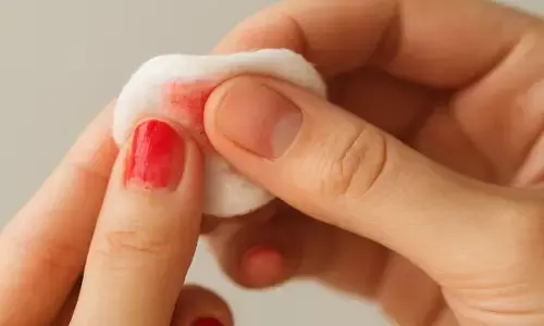 नेल पॉलिस हटाने का आसान तरीका