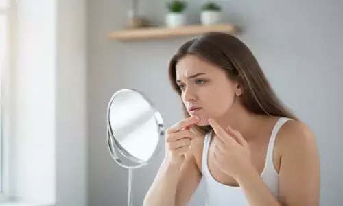 Home Remedies for Pimples