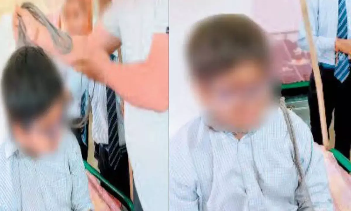 नवोदय विद्यालय में छात्र की बुलिंग : कमजोर आंखों वाले छात्र के गले में डाला फंदा