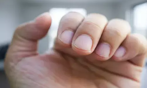 Nail health signs Nail health signs