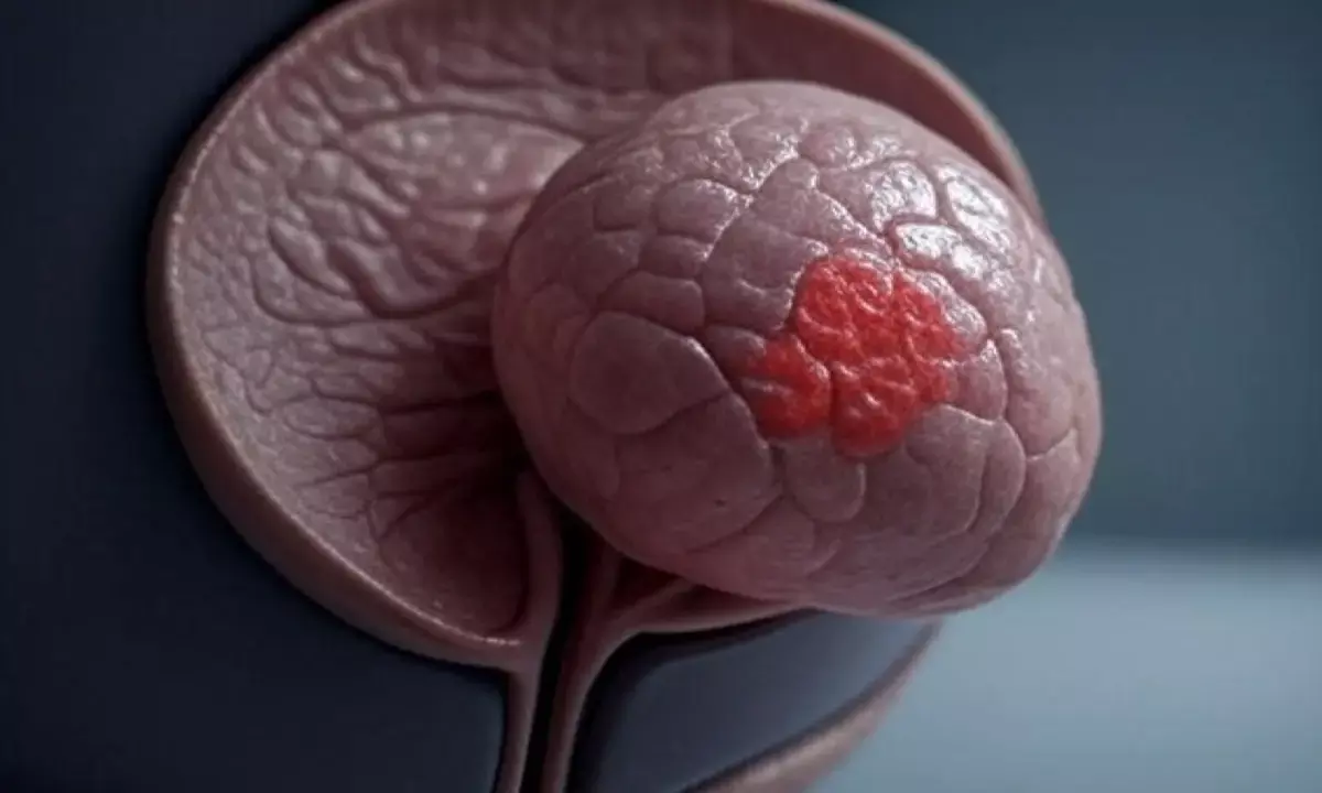 prostate-cancer-awareness-symptoms-treatment-indian-men prostate-cancer-awareness-symptoms-treatment-indian-men