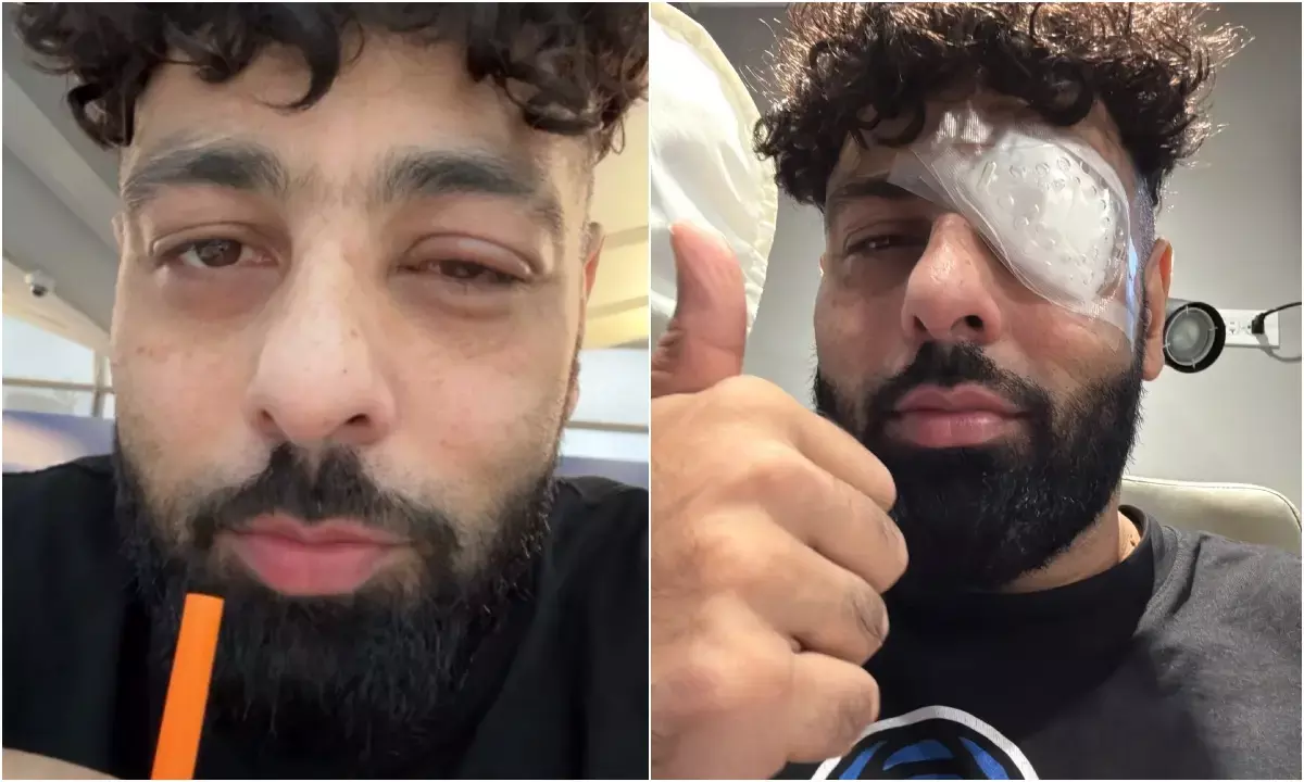 चोटिल हुए बादशाह, करानी पड़ी आंख की सर्जरी, पट्टी बांधे दिखे सिंगर