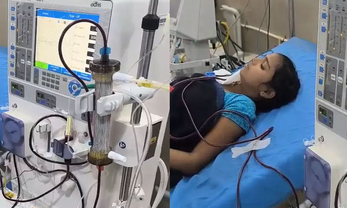 प्लाज़्माफ़ेरेसिस