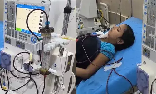 प्लाज़्माफ़ेरेसिस