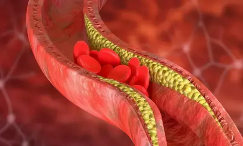 cholesterol reducing foods cholesterol reducing foods