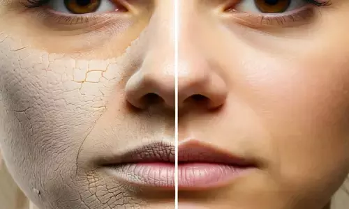 रूखी त्वचा को ठीक करने का उपाय