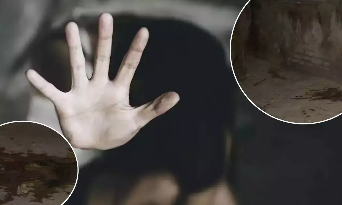 Acid Attack On DU Student