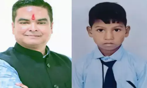 पटाखे में झुलसे बालक के इलाज की ली जिम्मेदारी, पिता ने लगाई थी मदद की गुहार