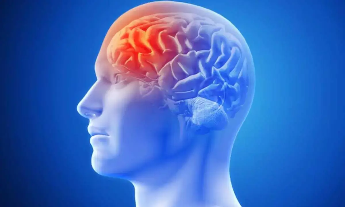 वर्ल्ड स्ट्रोक डे : तेज रफ्तार तनावभरी जीवनशैली से बढ़ रहा स्ट्रोक का खतरा वर्ल्ड स्ट्रोक डे : तेज रफ्तार तनावभरी जीवनशैली से बढ़ रहा स्ट्रोक का खतरा