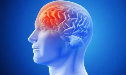 वर्ल्ड स्ट्रोक डे :  तेज रफ्तार तनावभरी जीवनशैली से बढ़ रहा स्ट्रोक का खतरा
