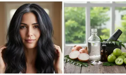 grey hairs home remedies