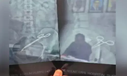 निजी हॉस्पिटल में डॉक्टर ने बरती थी लापरवाही : महिला के पेट में छोड़ दी थी कैंची, पांच साल बाद निकाला